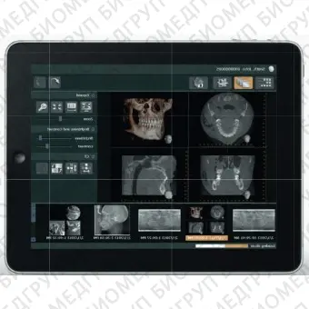 Программное обеспечение для обработки снимков зубов iDixel Web