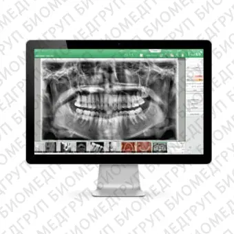 Программное обеспечение для обработки снимков зубов EzDenti