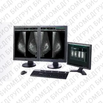 Информационная рабочая станция для маммографии ASPIRE Bellus II