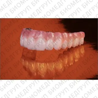 Циркониевый стоматологический протез BruxZir