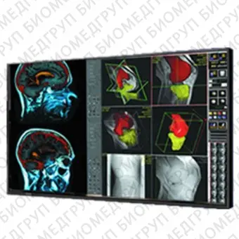 Double Black Imaging 42 Professional LCD Медицинский монитор
