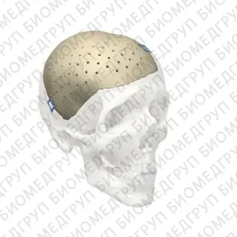 Черепной имплантат на заказ Cranial iD