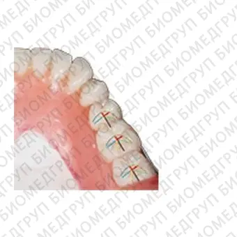 Стоматологический протез из акрила Tribos 501