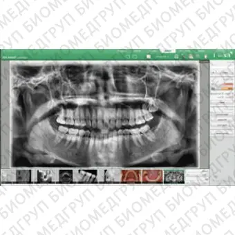 Программное обеспечение для обработки снимков зубов EzDenti