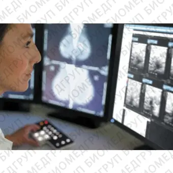 Информационная рабочая станция для маммографии IntelliSpace Breast