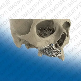 Материалы для челюстнолицевого восстановления  Nylon12