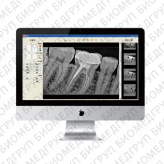 Интраоральный плоскопанельный детектор для стоматологической радиографии HDR100/200
