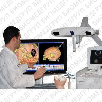 Система хирургической навигации для нейрохирургии SNAP