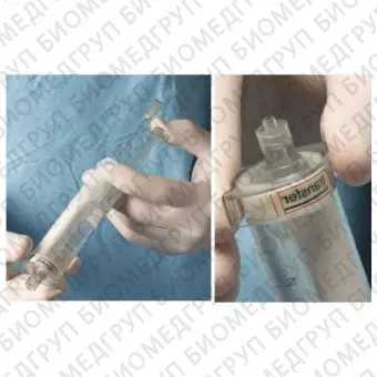 Костный цемент для ортопедической хирургии Eurobone 2