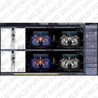 Программное обеспечение для медицинских снимков Xelis Fusion