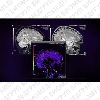 Программное обеспечение для МРТ SPHERE 3.0 Neuro