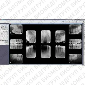 Программное обеспечение для обработки снимков зубов DBSWIN