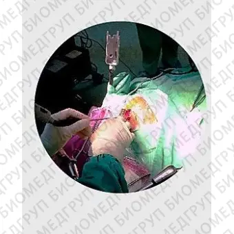 Система хирургической навигации для нейрохирургии RETINA