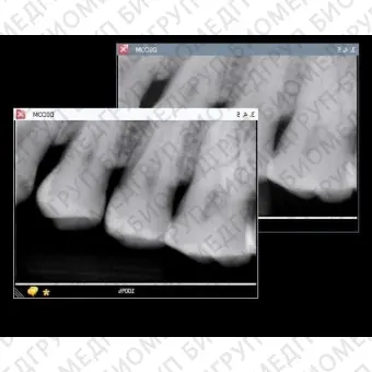 Программное обеспечение для обработки снимков зубов PROGENY