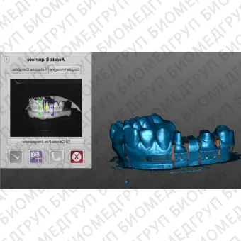 Программное обеспечение для обработки снимков зубов OpticalRevEng Dental 3.0