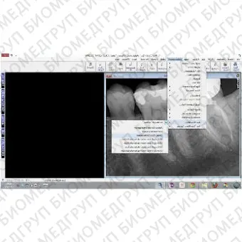 Программное обеспечение для обработки снимков зубов Prof. Suni