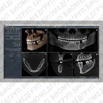 Программное обеспечение для обработки снимков зубов SIDEXIS 4