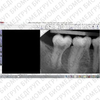 Программное обеспечение для обработки снимков зубов Prof. Suni