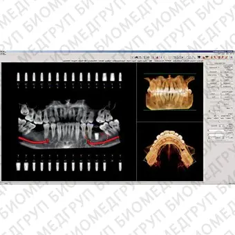Программное обеспечение для обработки снимков зубов Invivo 6
