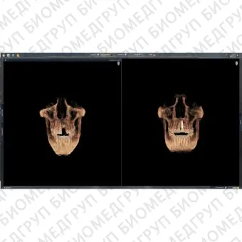 Программное обеспечение для обработки снимков зубов SIDEXIS 4