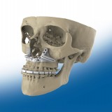 Материалы для челюстно-лицевого восстановления  Nylon-12