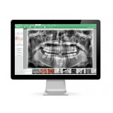 Программное обеспечение для обработки снимков зубов EzDent-i