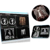 Программное обеспечение для рентгенологии VisionHM MPR Radiology