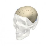 Черепной имплантат на заказ Cranial iD