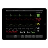 Приложение iOS для медицинской симуляции TruMonitor