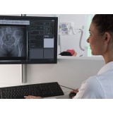 Программное обеспечение для рентгенологии X Vision